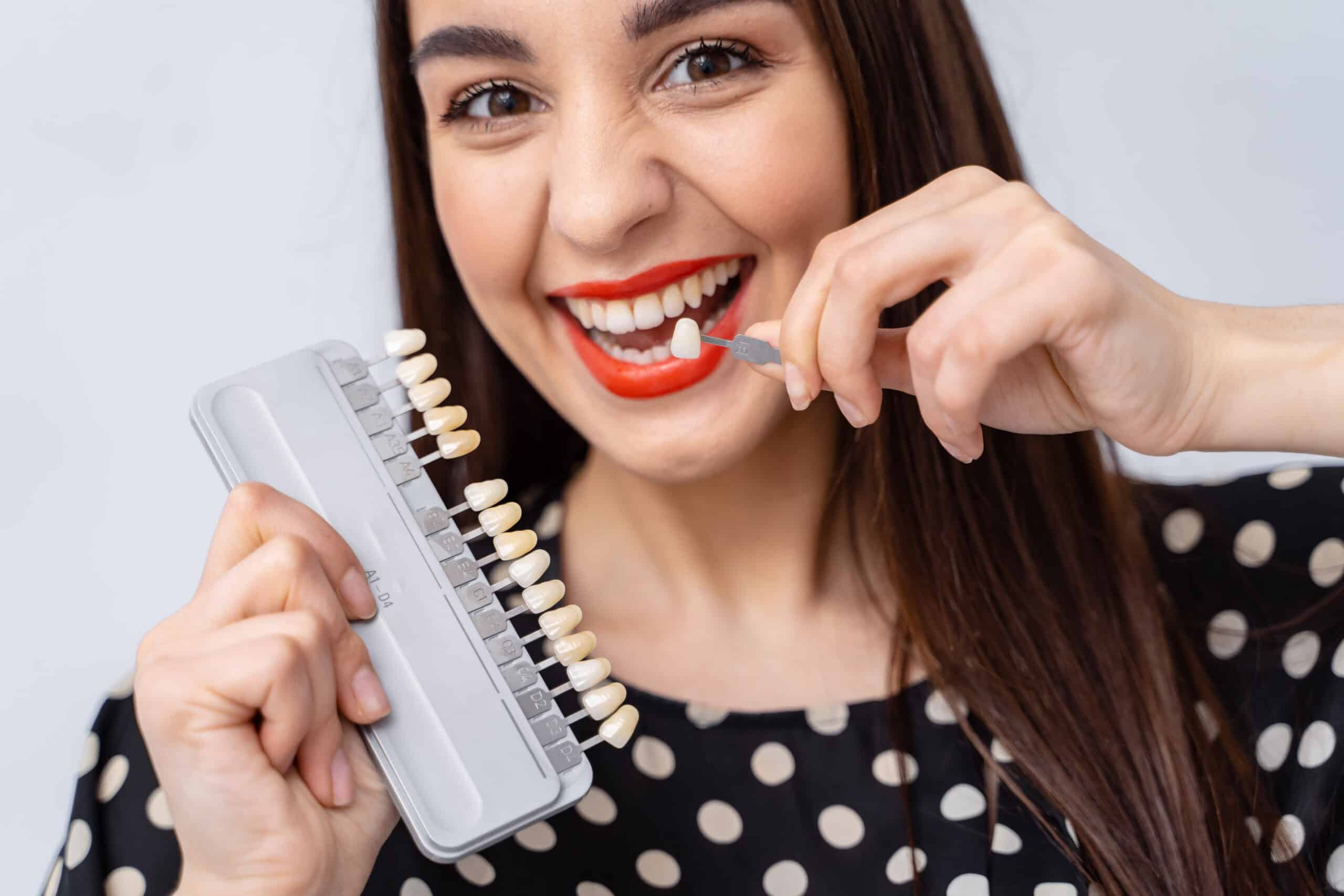 A young female is showcasing her no prep veneers