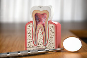 Root canal treatment illustration showing tooth anatomy, dental pulp, nerves, and root canals for endodontic care guide.