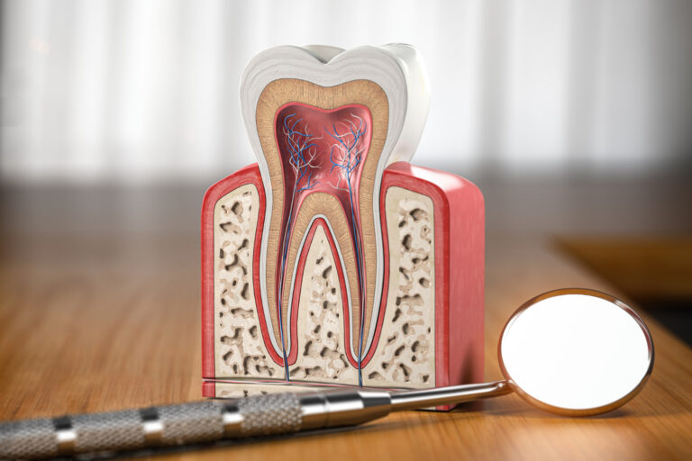 Root canal treatment illustration showing tooth anatomy, dental pulp, nerves, and root canals for endodontic care guide.