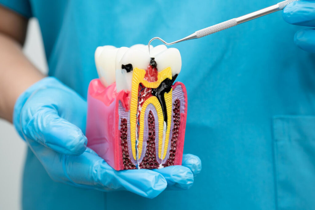Dentist examining a tooth model showing root canal treatment, tooth infection, and detailed dental anatomy during visit.