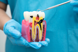Dentist examining a tooth model showing root canal treatment, tooth infection, and detailed dental anatomy during visit.
